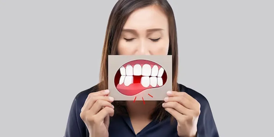 Consecințele lipsei dinților