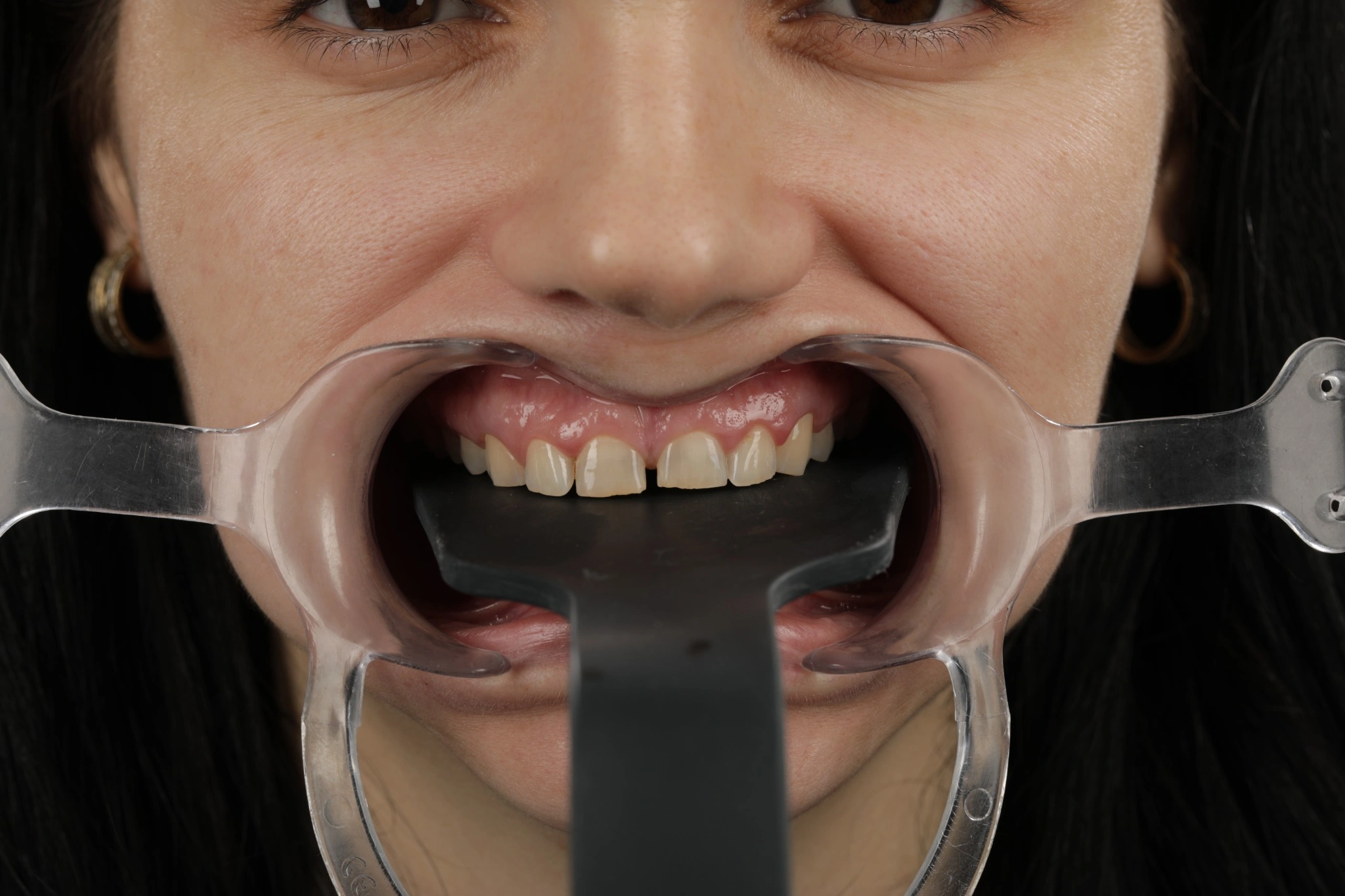 Caz clinic – înainte