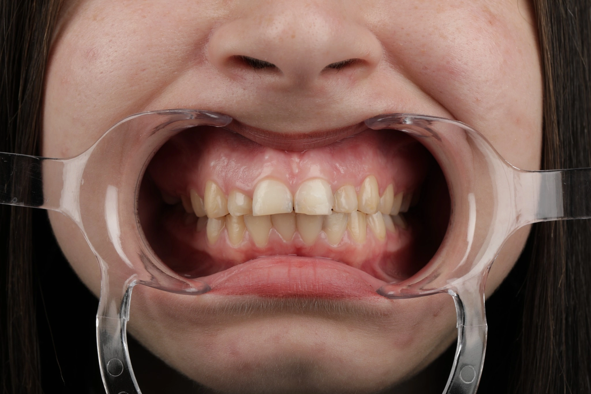 Caz clinic – înainte